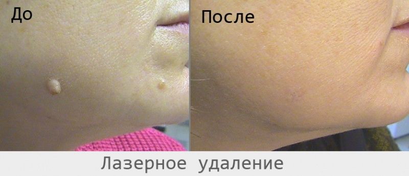 16028 Аппарат электрокоагуляции -112 (GT-112) DIY  - Вид №4