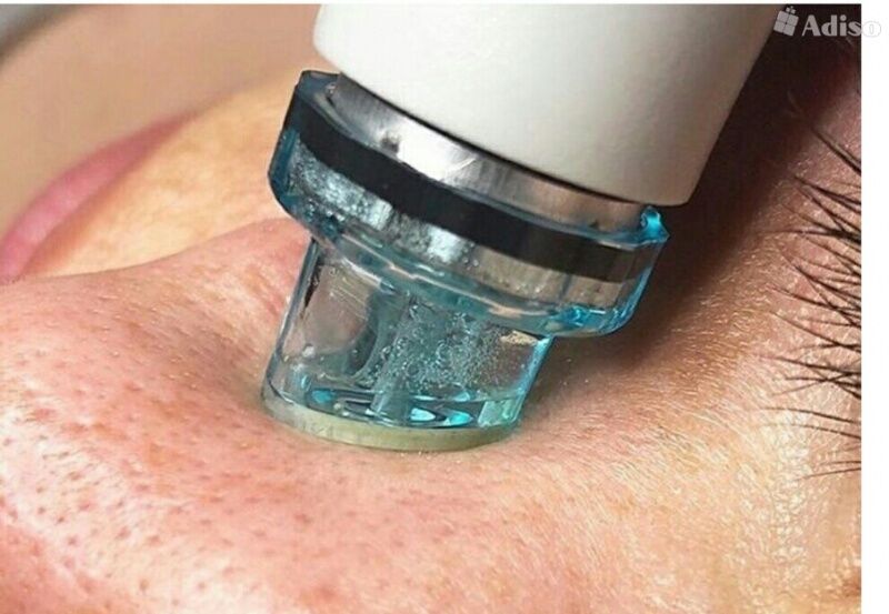 37466 Аппарат вакуумного и водородного гидропилинга 6 в 1 NOVA H2O2 (RL-D07, W05X) Nova NewFace (НОВА НьюФейс)  - Вид №7