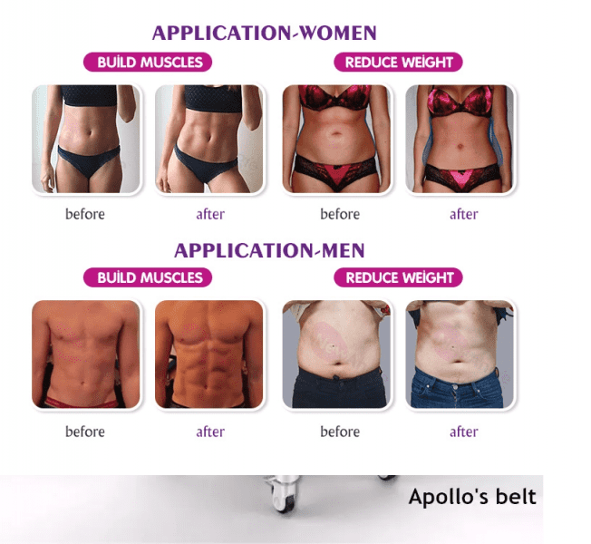 52441 Аппарат миостимуляции HI-EMT BODYSCULPT PRO AURO  - Вид №5