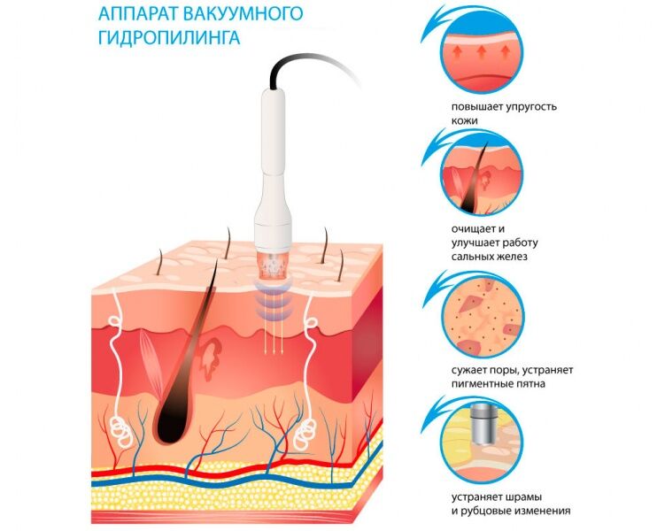 37466 Аппарат вакуумного и водородного гидропилинга 6 в 1 NOVA H2O2 (RL-D07, W05X) Nova NewFace (НОВА НьюФейс)  - Вид №6